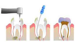 Endodontie
